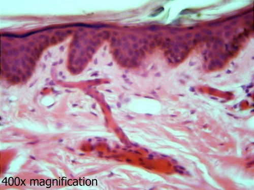 Human skin slide, white, section