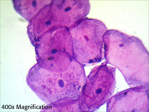 Human squamous epithelium slide, smear