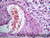 Human Pathology Slide Set
