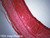 Trachea slide, section