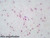 Human sperm slide, smear