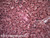 Human liver slide, section