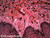 Human tonsil slide, section