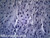 Human muscle slide, cardiac, section