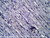Muscle slide, 3 types, section