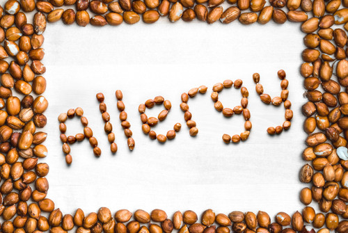 Four Tips to Prevent Allergen Cross-Contact in Restaurants