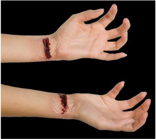 Slashed Wrist Prosthtic