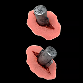 Frankenstein Bolts Latex Appliance | Frankenstein | Tinsley | Prosthetics | Special Effects