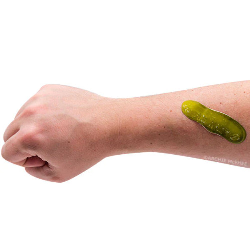 Pickle Bandages- on arm