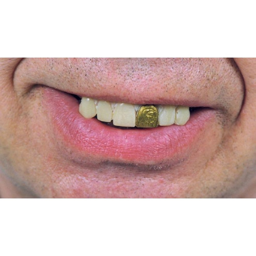 Gold Miner Glow Teeth