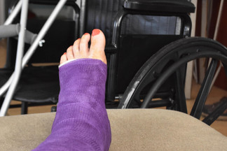 Wheelchair for Broken Leg: Choosing the Right One Wheelchair for Broken Leg: Choosing the Right One
