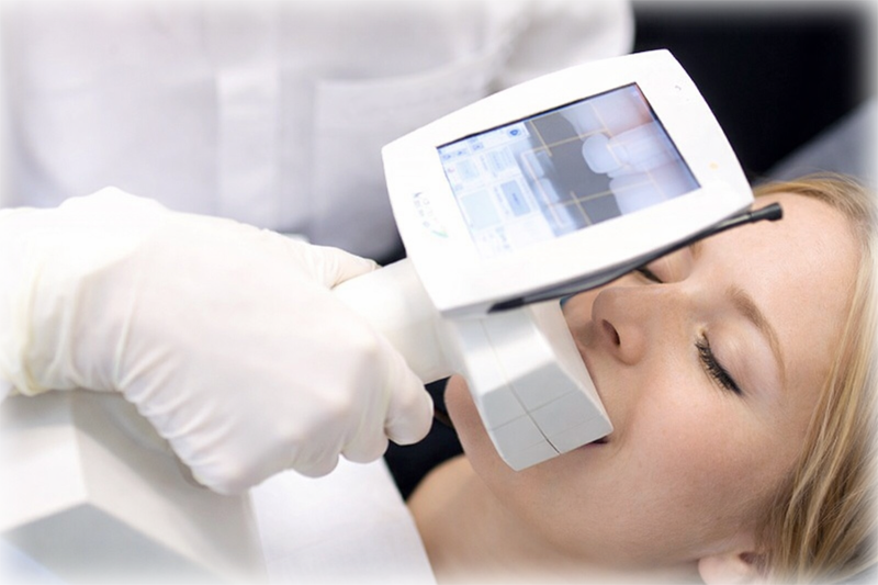 Align the guide on the SpectroShade Micro device according to instructions