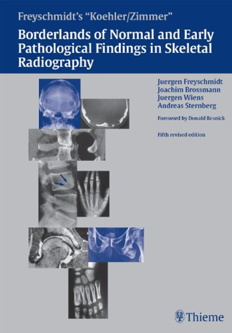 http://axebook.shop/wp-content/uploads/2025/03/zimmers-borderlands-of-normal-and-early-pathological-findings-in-skeletal-radiography-5th-edition-pdf-book.jpg http://axebook.shop/wp-content/uploads/2025/03/zimmers-borderlands-of-normal-and-early-pathological-findings-in-skeletal-radiography-5th-edition-pdf-book.jpg