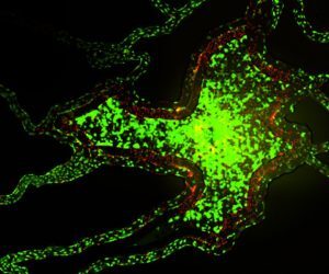 Imaging Results of Tumor-Endothelial Interactions in microvascular networks