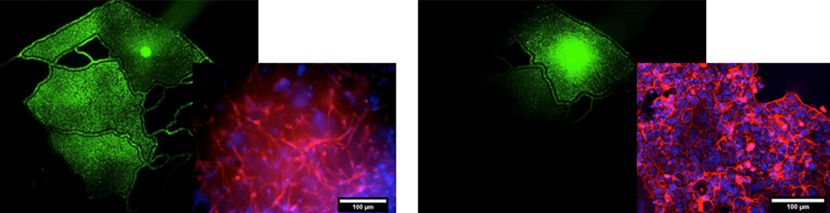 Imaging Results of Metastatic Potential Characterization - image shows stained images highlighting elongated protrusions for metastatic tumor in contrast to localized for non-metastatic tumor.