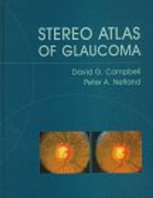 Stereo Atlas Of Glaucoma, 1e