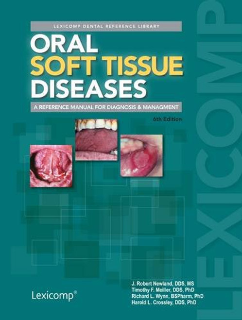 Oral Soft Tissue Diseases (Lexicomp Dental Reference Library)