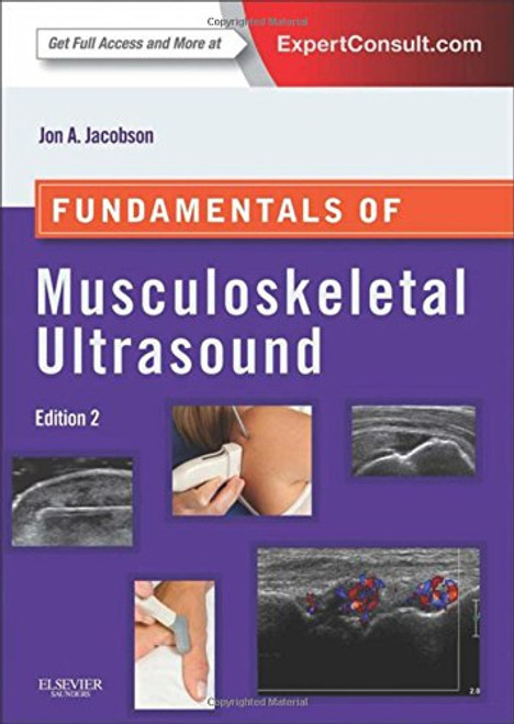 Fundamentals of Musculoskeletal Ultrasound, 2e (Fundamentals of Radiology)