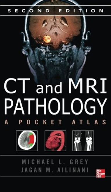 CT & MRI Pathology: A Pocket Atlas, Second Edition