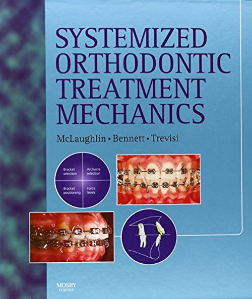 Systemized Orthodontic Treatment Mechanics, 1e