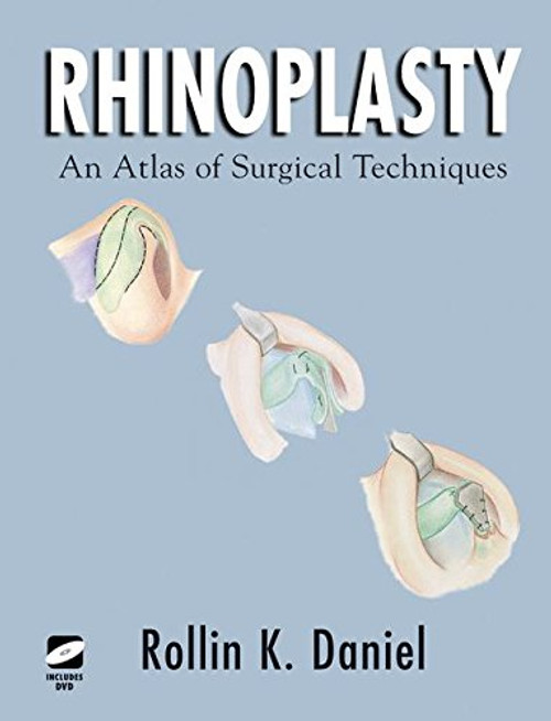 Rhinoplasty: An Atlas of Surgical Techniques