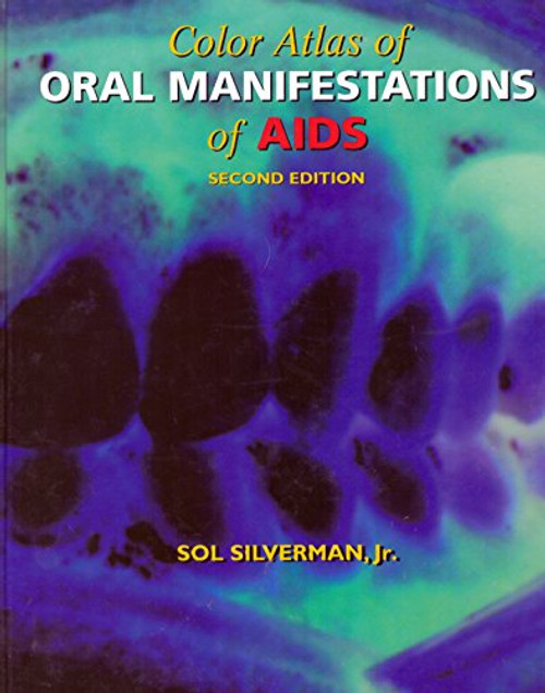 Color Atlas Of Oral Manifestations Of Aids, 2e