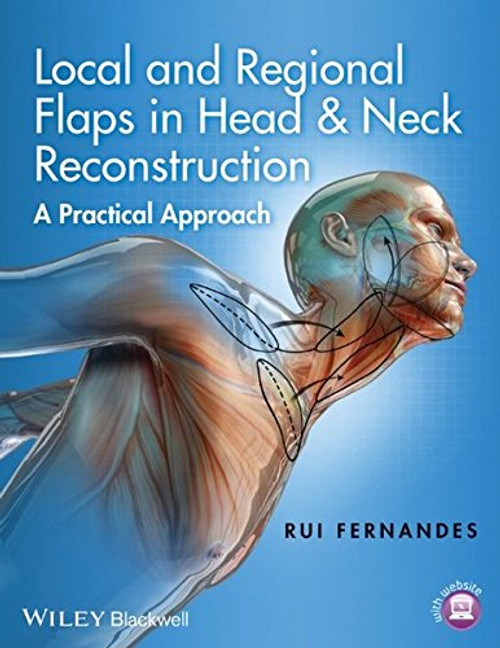 Local and Regional Flaps in Head and Neck Reconstruction: A Practical Approach