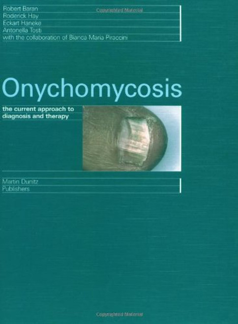 Onychomycosis: The Current Approach to Diagnosis and Therapy