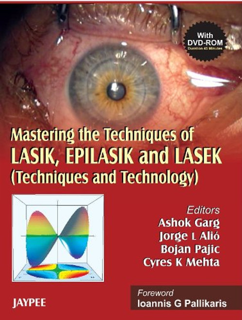 Mastering the Techniques of LASIK, EPILASIK and LASEK: Techniques and Technology