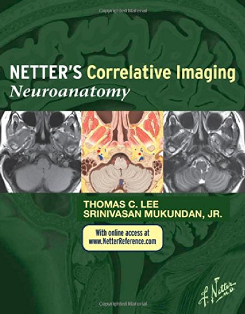 Netters Correlative Imaging: Neuroanatomy: with NetterReference.com Access, 1e (Netter Clinical Science)