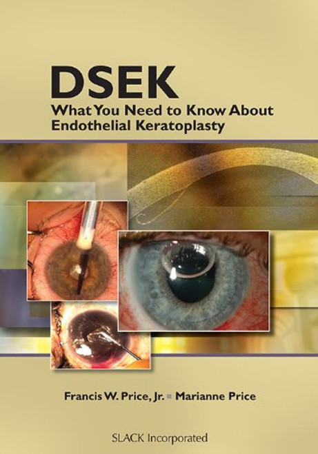 DSEK: What You Need to Know About Endothelial Keratoplasty