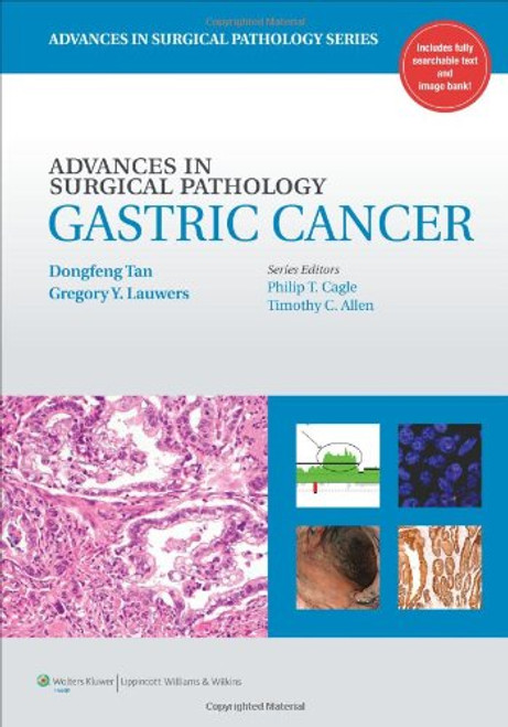 Advances in Surgical Pathology: Gastric Cancer