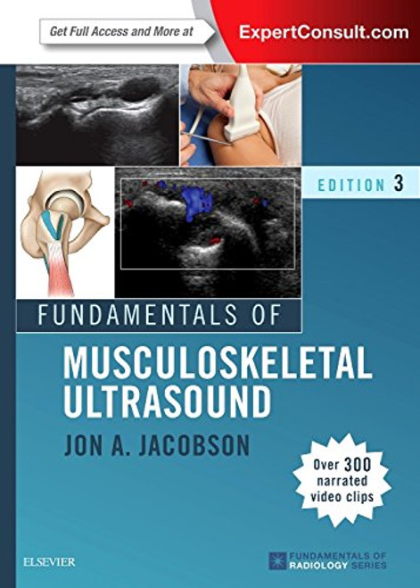 Fundamentals of Musculoskeletal Ultrasound, 3e (Fundamentals of Radiology)