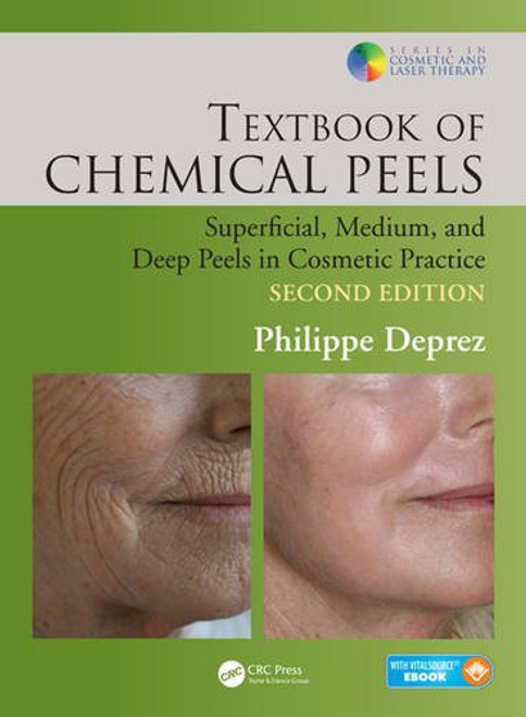 Textbook of Chemical Peels, Second Edition: Superficial, Medium, and Deep Peels in Cosmetic Practice (Series in Cosmetic and Laser Therapy)