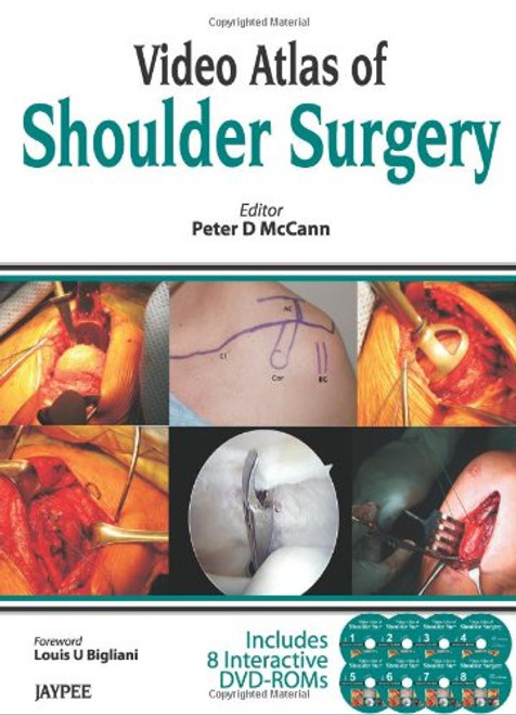 Video Atlas of Shoulder Surgery (DVDs)