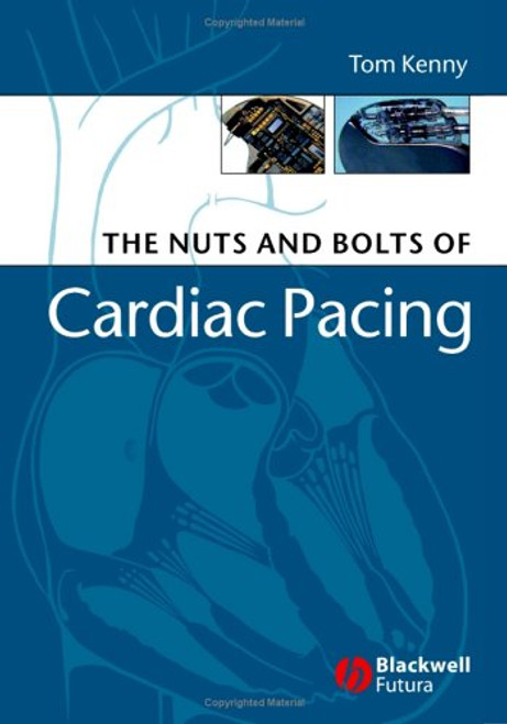 The Nuts and Bolts of Cardiac Pacing (Nuts and Bolts Series (Replaced by 5113))