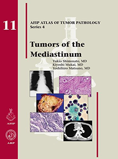 11: TUMORS OF THE MEDIASTINUM (Atlas of Tumor Pathology)