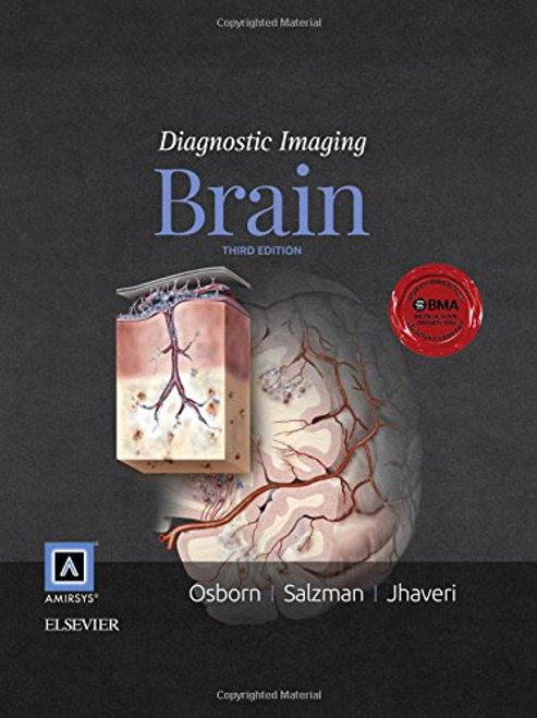 Diagnostic Imaging: Brain, 3e