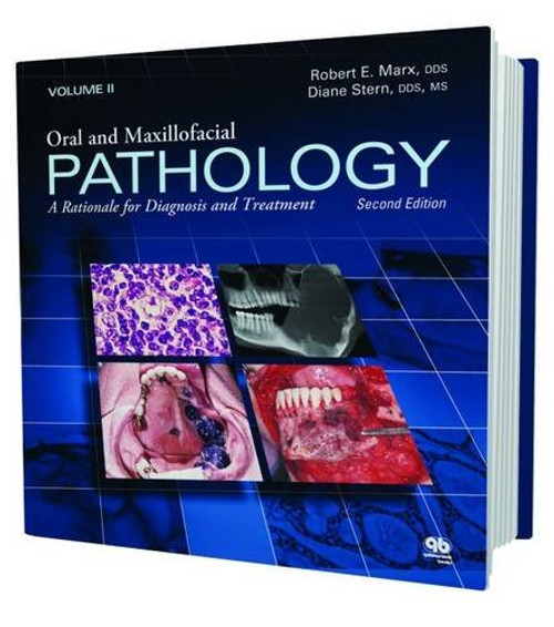 Oral and Maxillofacial Pathology: A Rationale for Diagnosis and Treatment