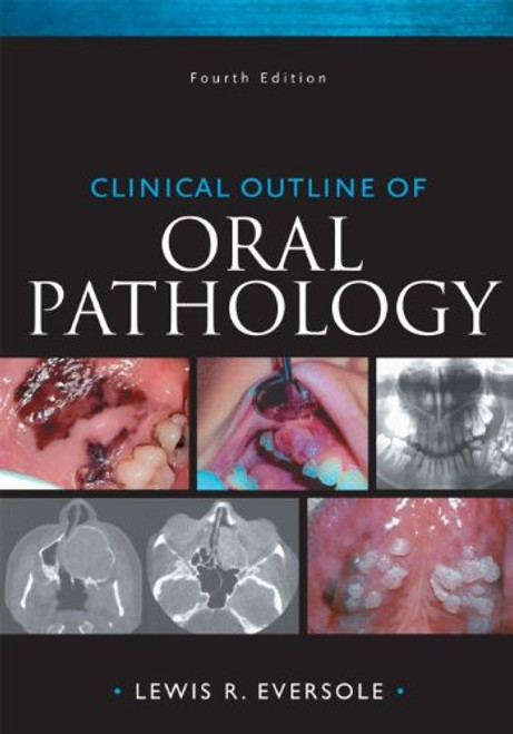Clinical Outline of Oral Pathology, 4e