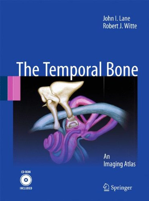 Temporal Bone: An Imaging Atlas