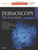 Dermoscopy: The Essentials: Expert Consult - Online and Print, 2e
