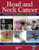 Head and Neck Cancer: Treatment, Rehabilitation, and Outcomes