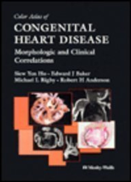 Color Atlas of Congenital Heart Disease