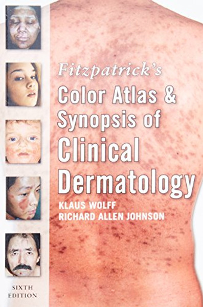 Fitzpatrick's Color Atlas and Synopsis of Clinical Dermatology: Sixth Edition (Fitzpatrick's Color Atlas & Synopsis of Clinical Dermatology)