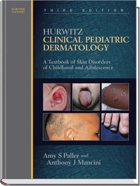 Hurwitz Clinical Pediatric Dermatology: A Textbook of Skin Disorders of Childhood and Adolescence, 3e