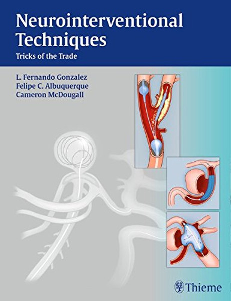 Neurointerventional Techniques: Tricks of the Trade