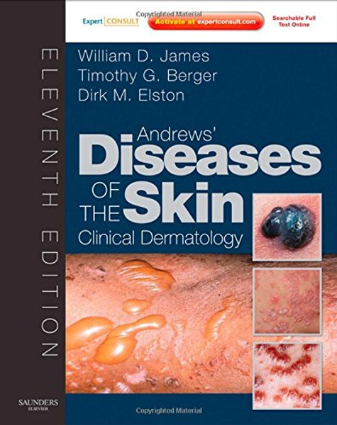 Andrews' Diseases of the Skin: Clinical Dermatology - Expert Consult - Online and Print, 11e (James, Andrew's Disease of the Skin)