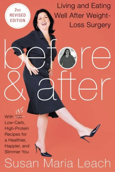 Before & After, Second Revised Edition: Living and Eating Well After Weight-Loss Surgery