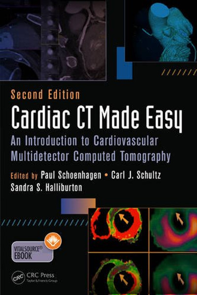 Cardiac CT Made Easy: An Introduction to Cardiovascular Multidetector Computed Tomography, Second Edition (Volume 1)